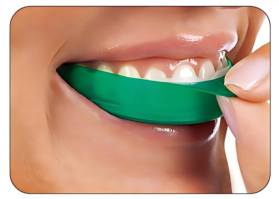 Teeth Whitening Opalescence Go - Ultradent Opalescence Go Zahnaufhellungsstreifen 6% HP