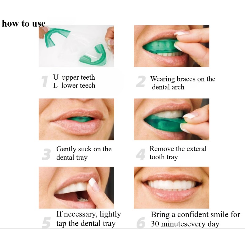 Set Zahnaufhellungstablett, U- – Teeth Whitening Tray Bewertung und Preis