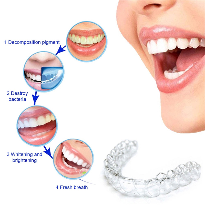 Komfortabler Silikon-Mundschut – Teeth Whitening Tray Bewertung und Preis