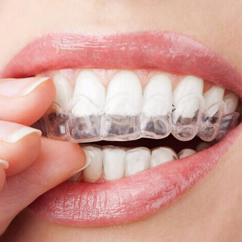 1 stück Transparent Thermo Zäh – Teeth Whitening Trays Bewertung und Preis