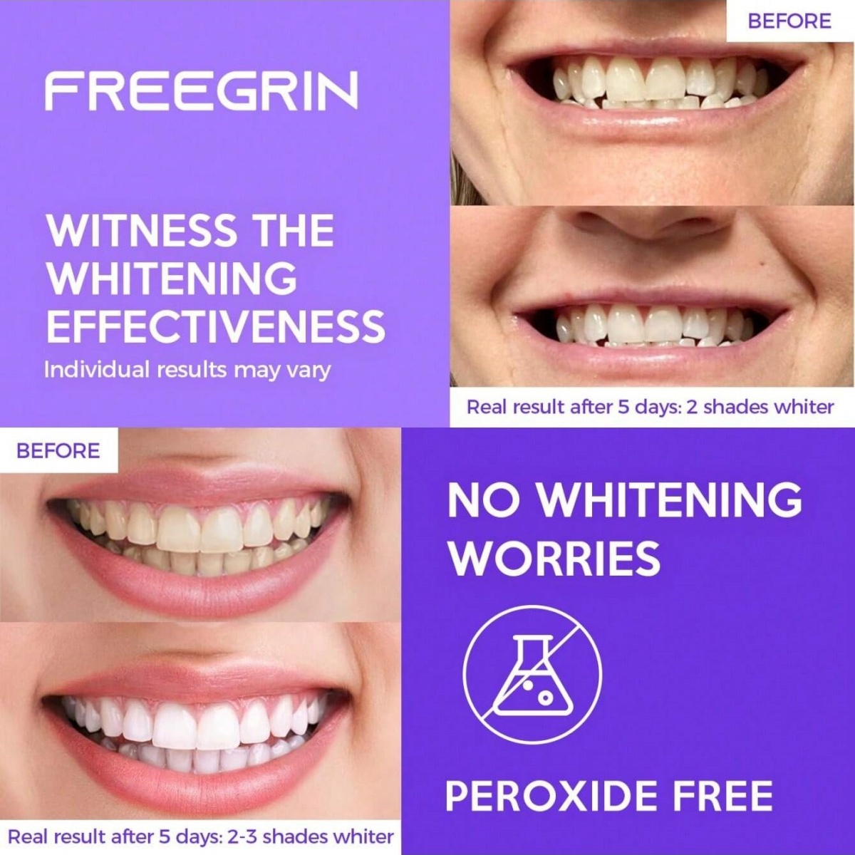 Deluxe Zahnaufhellungsaufklebe – Teeth Whitening Gel Refills Bewertung und Preis