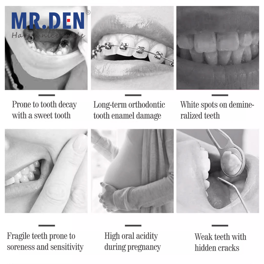 Japan GC Fluorid Enhanced Dent – Teeth Whitening In Japan Bewertung und Preis