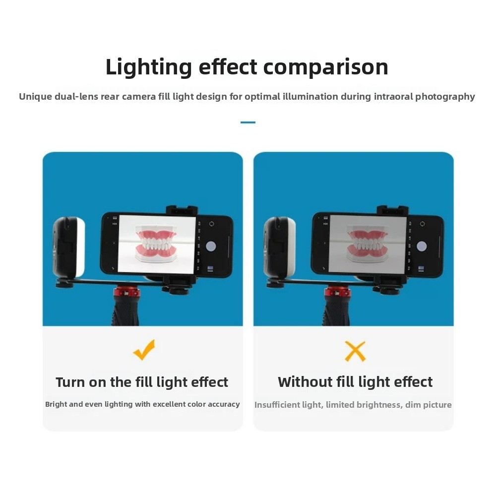 Licht für zahnärztliche Fotogr – Teeth Whitening Flash Bewertung und Preis