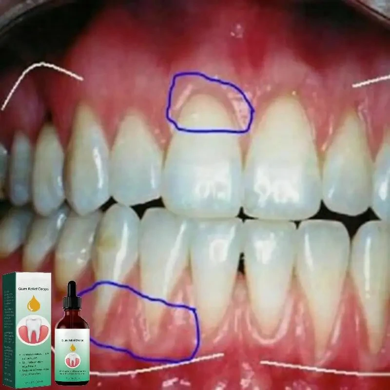 Zahnfleisch reparatur tropfen  – Teeth Whitening Paste Bewertung und Preis