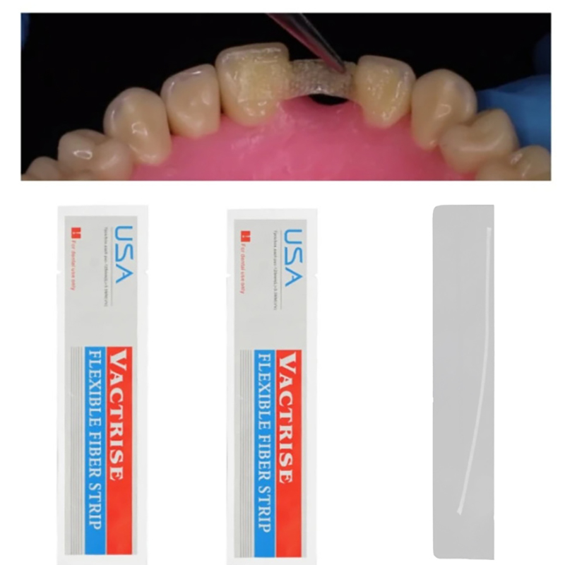 1 Stück Dental Flexibler Glasf – Teeth Whitening Zoom Bewertung und Preis