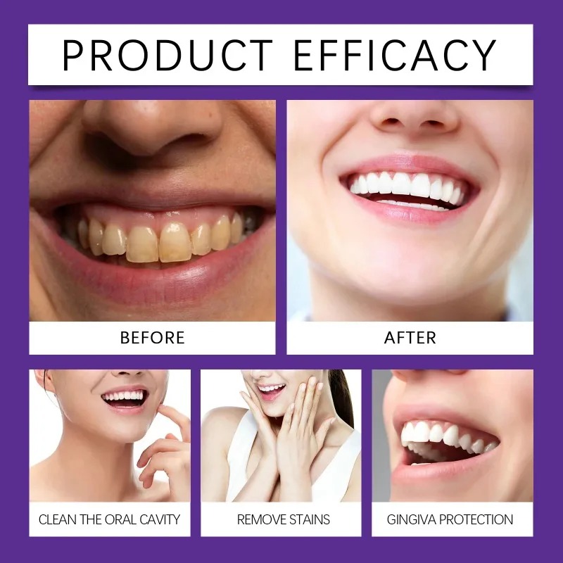 Lila Zahnrestaurations-Mineral – Teeth Whitening Flash Bewertung und Preis
